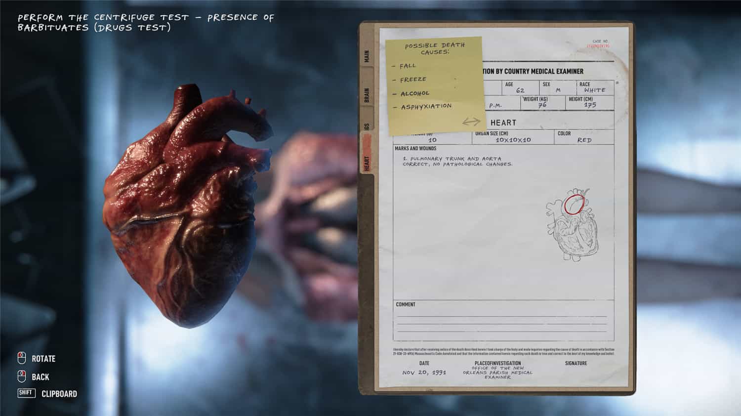 1717722638822996.jpg 验尸模拟器/Autopsy Simulator