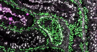 男性避孕重大突破：靶向减数分裂实现安全可逆的非激素方案