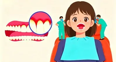 小小黑线毁一口牙，做好清洁远离根管治疗